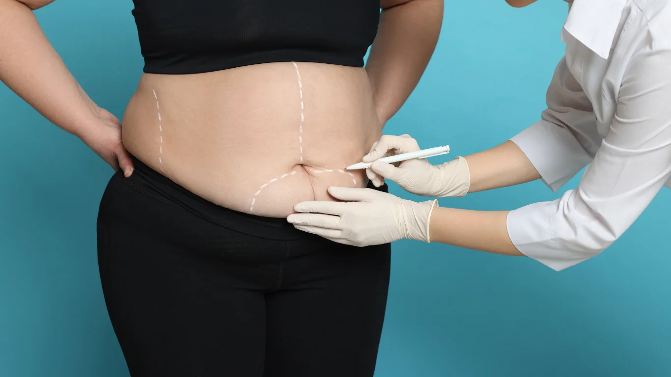 Cirurgia Bariátrica do Início ao Fim: Quando Indicar, Quais as Opções e Como é a Vida Depois